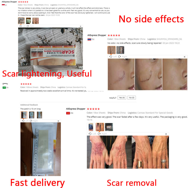 Scars Sheet Remove Scar hyperplasia Keloids Burn Surgical Scar Treatment Efficient Repair Damaged Skin Pregnancy Wrinkles Cream