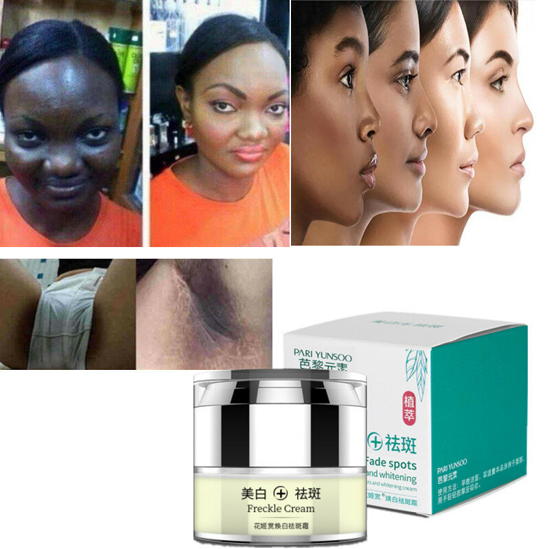 ผู้หญิง Private Parts Herbal Whitening และครีม Freckle ต้นขาด้านในครีม Strong Dark Spot Eraser Flawless Skin