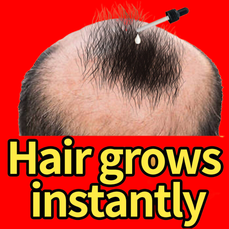 Fast Hair Growth Products Hair Regrowth Essential Oils Anti Hair Loss Treatment Scalp Effective Baldness Repair Beauty Health