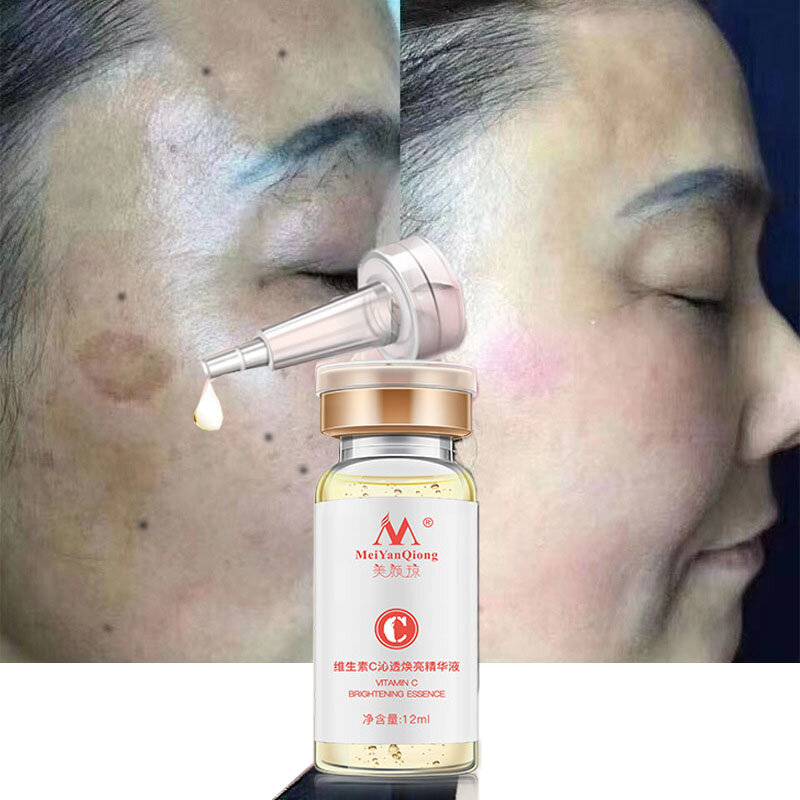 Vitamin C Whitening Face Serum Remove Dark Spots Freckles Blemish Wrinkles Anti-Aging Moisturizing Nourishing Essence Skin Care