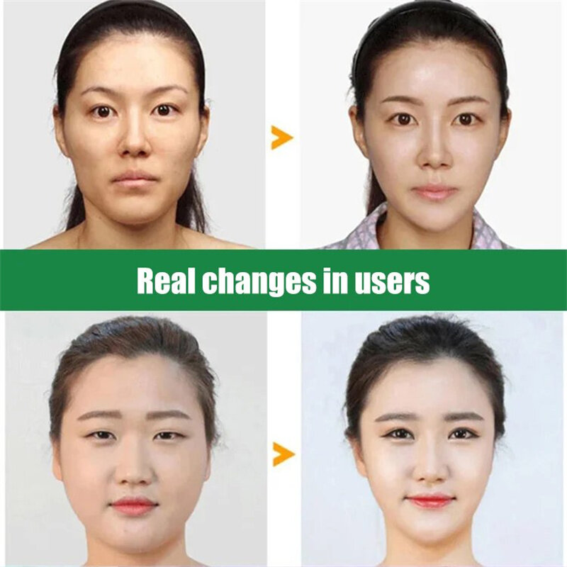 Dispositivo di sollevamento facciale a forma di V a microcorrente terapia fotonica massaggiatore dimagrante facciale dispositivo di sollevamento facciale a doppio mento EMS