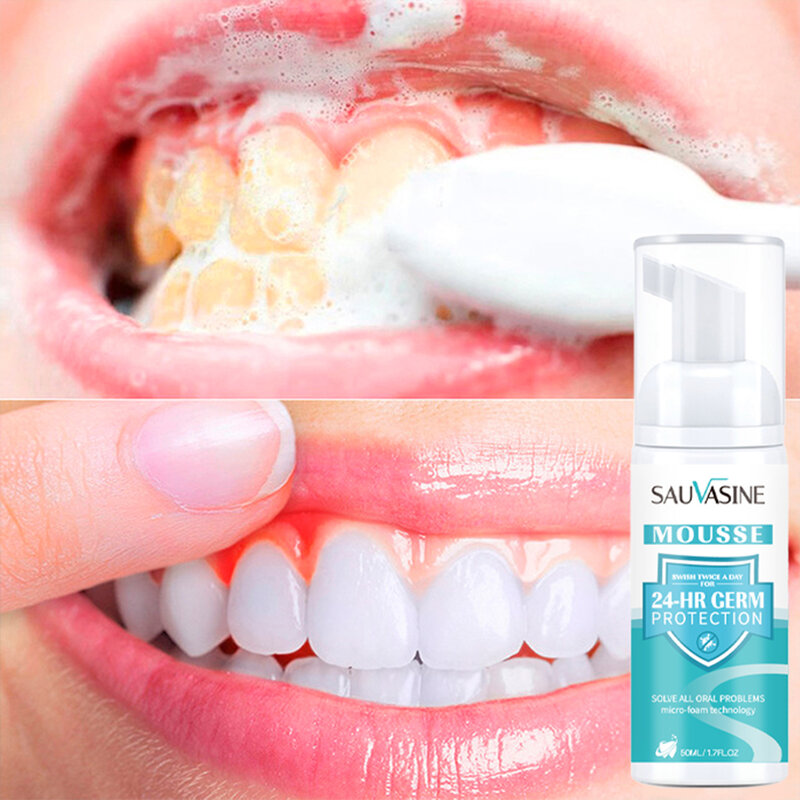 Professional Teeth Whitening Mousse Foam Deep Cleaning Stain Removal Remover Treatment to Whiten and Brighten Toothpaste Travel