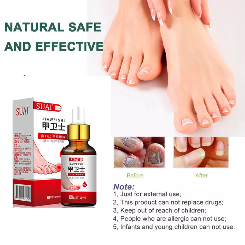 Tratamento fúngico do prego soro onychomycosis paronychia anti infecção dedo do pé fungo mão pé reparação gel cuidados beleza saúde