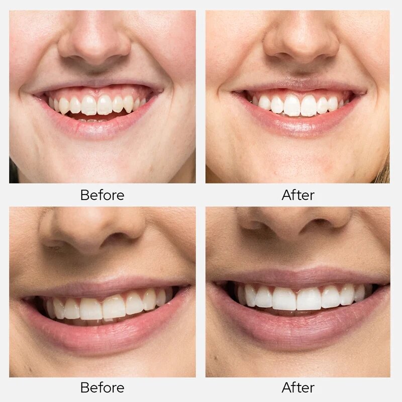 Flow Week 5D белые отбеливание зубов полоски Отбеливание зубов удаление пятен зубов Гигиена полости рта Ложные зубы виниры