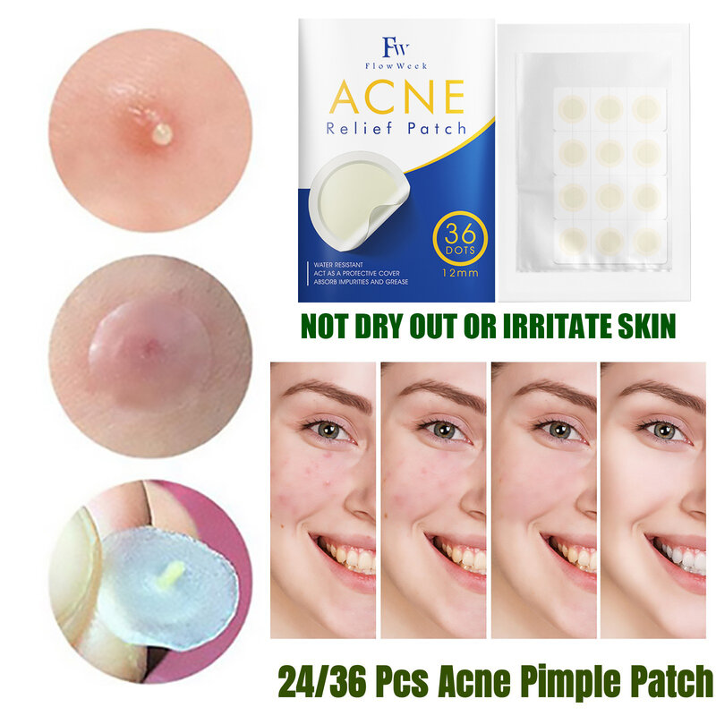Flow Week Acne Patch Face Acne Pimple Spot Scar Care Treatment Stickers Pimple Patches for Face Facial Skin Care Acne Mask