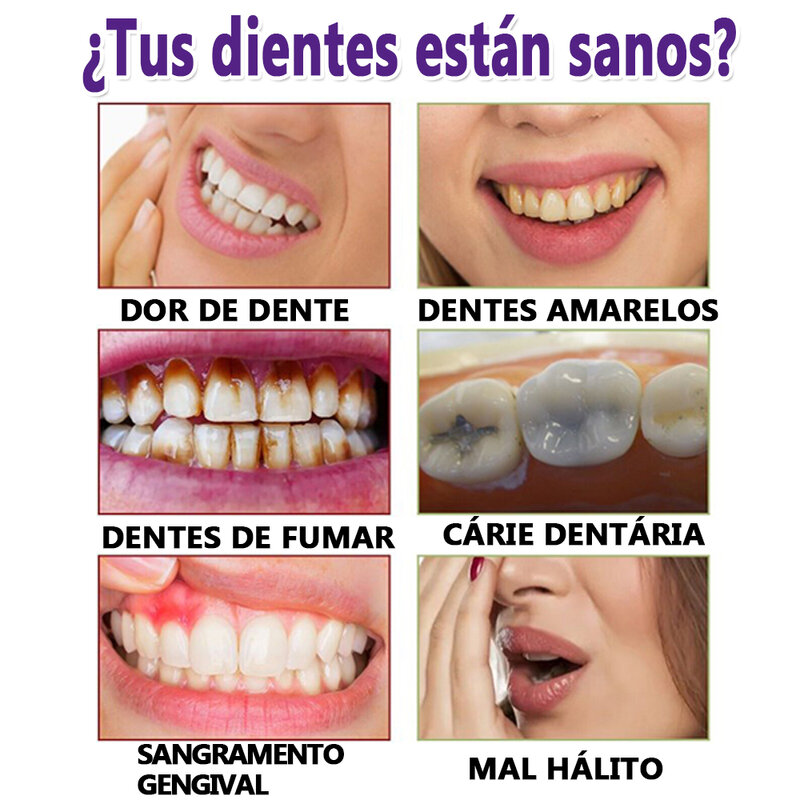 Dentes brancos brilhantes Reparação Dentífrico, Anti-Sensitive Gel, Clareamento Dentífrico, Remove manchas de fumaça, Placa, Respiração Fresca, V34