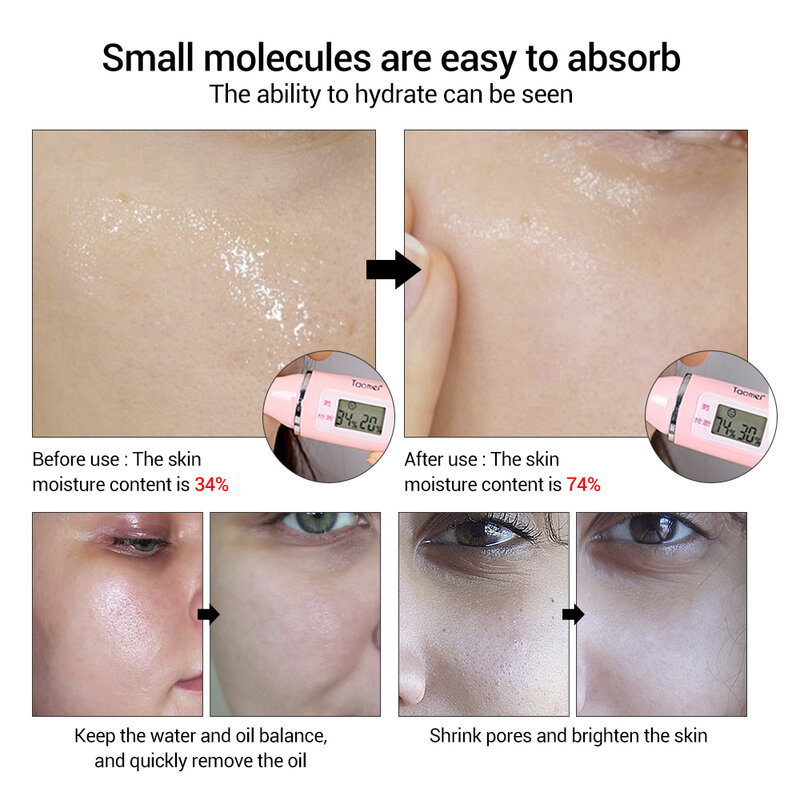 Lanbena soro ácido hialurónico cravo remoção hidratante tratamento acne cuidados com a pele reparação clareamento anti-envelhecimento winkles msl01