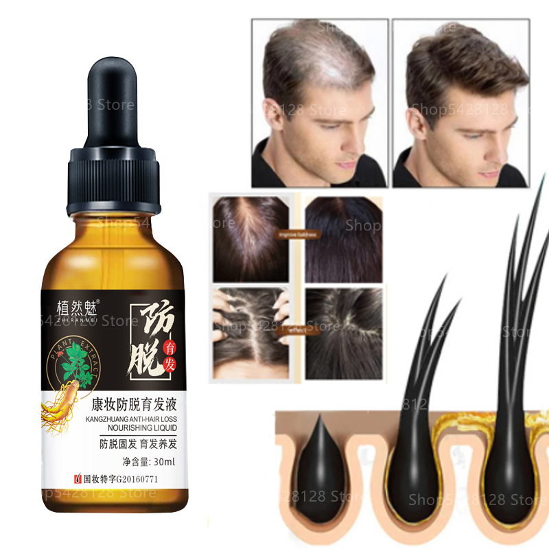 Hair Growth Anti-Hair Loss Essential Oil Helps Hair Growth Pure Plant Fast Hair Growth Hair Care Anti-Hair Loss Scalp Treatment