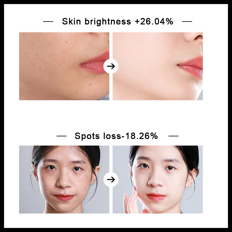 Whitening Face Cream Removing Pigmentation Lightening Black Spots Age Spots Moisturizing Brightening Firming Skin Care 50g