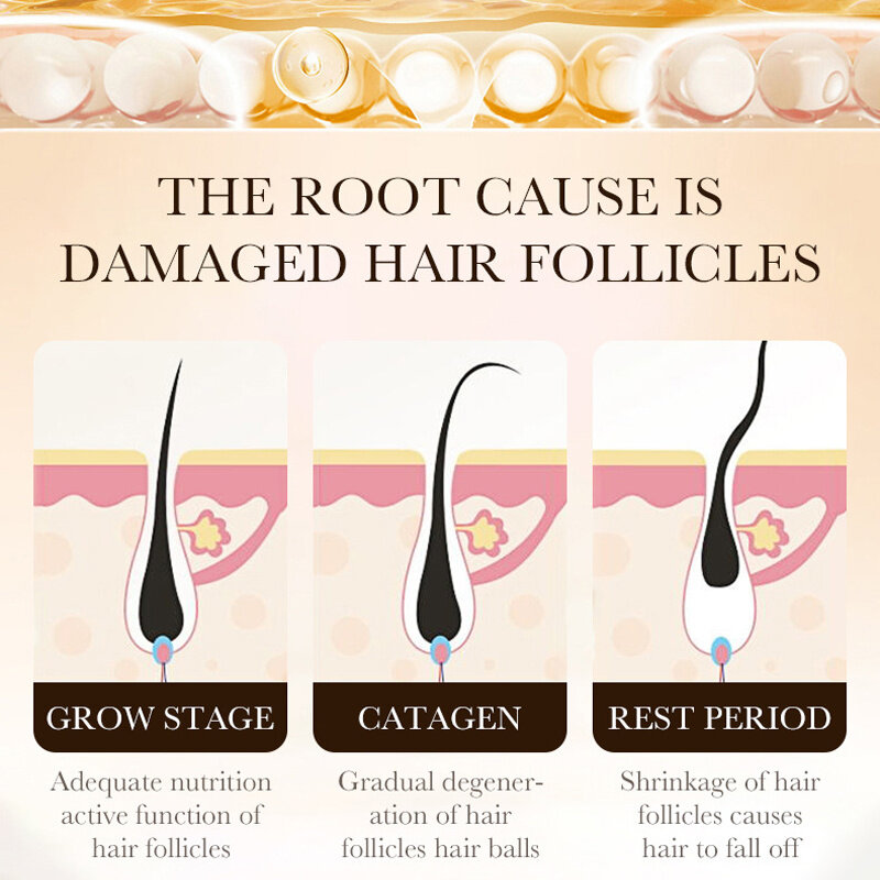 Fast Hair Growth Essence Effective Anti Hair Loss Serum Baldness Repair Hereditary Postpartum Seborrheic Hair Loss Hair Care