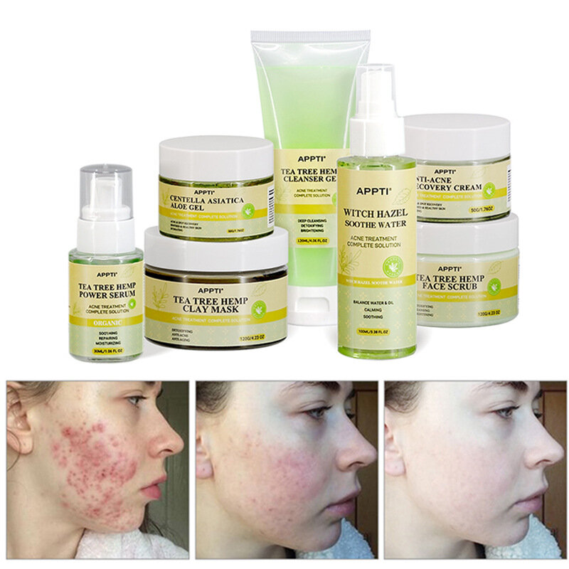 Tea Tree Acne Treatment Facial ชุด Efectively ลบสิวหัวดำสิวรอยแผลเป็นรูขุมขน Repair เซรั่มครีม Skin Care Product
