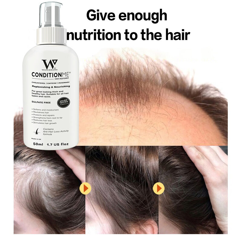 Esencia de crecimiento del cabello espesante, esencia de regeneración, tratamiento, aceite de crecimiento rápido, productos para el cuidado de la pérdida de cabello, hombres y mujeres