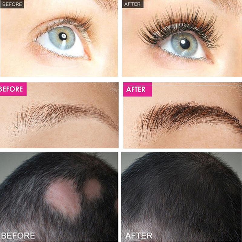 Suero para el crecimiento de pestañas y cejas, crecimiento rápido, previene la caída del cabello, tratamiento dañado, ojos densos y gruesos, productos para el cuidado del maquillaje