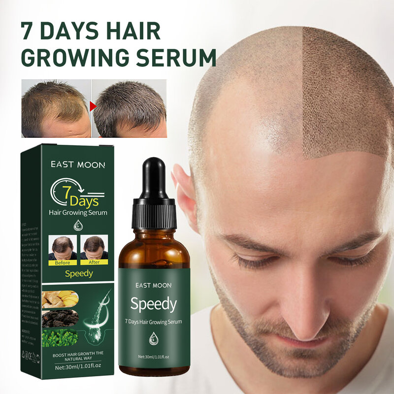 7 giorni Ginger Hair Growth Serum ripara efficacemente la perdita di capelli genetici calvi perdita di capelli dopo il parto Alopecia seborroica crescita rapida