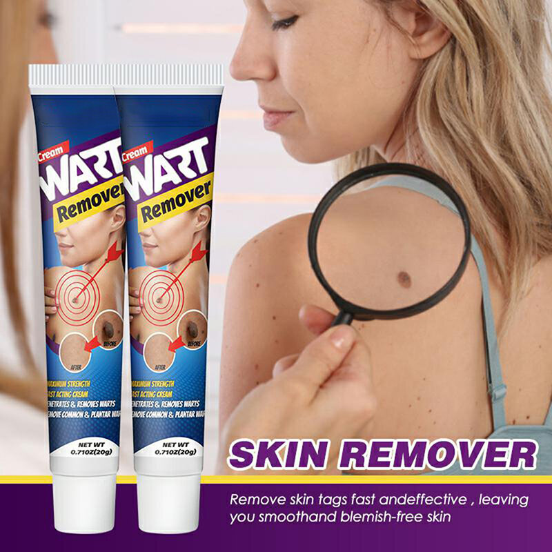 20G Skin Tag Remover Crème Pijnloze Mol Huid Donkere Vlek Wratten Remover Serum Sproet Gezicht Huid Nek Wrat Tag Verwijdering Huidverzorging
