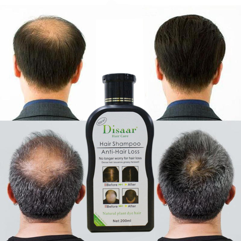 Champú Natural anticaída para el cabello, suero de tratamiento para el crecimiento del cabello más grueso, mejora el tónico del cabello, limpia el cuero cabelludo, esencia reparadora de daños, 200ml