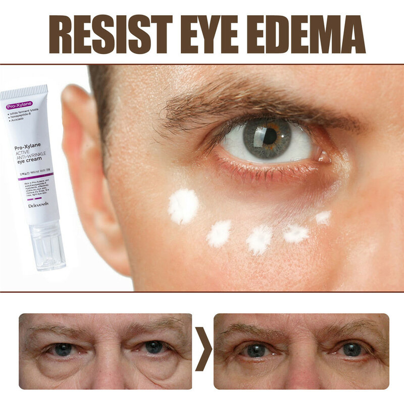 しわ防止アイクリーム,目の下のシミを減らす美容液,にきびの除去,20g