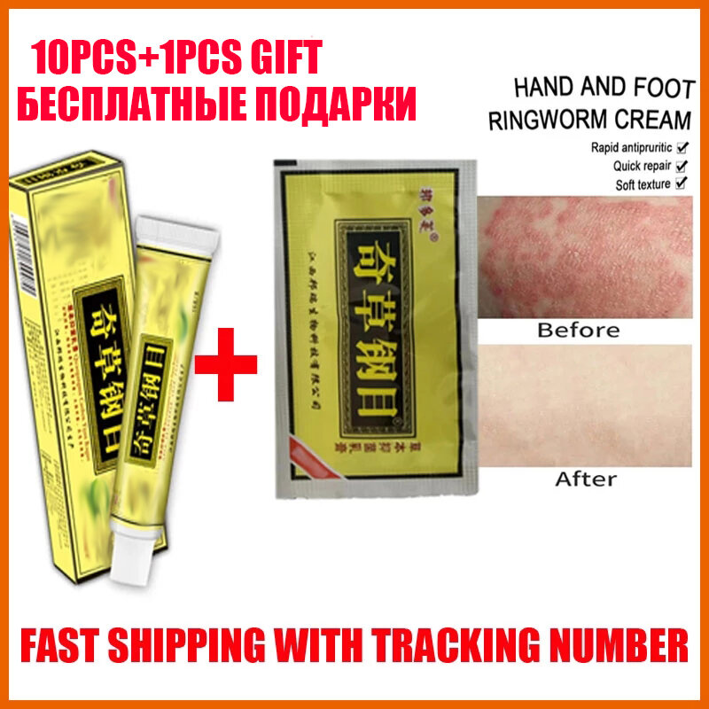 10 pces psoríase pele creme dermatite eczematoid eczema pomada tratamento psoríase escamosa psoríase creme de saúde qicaogangmu
