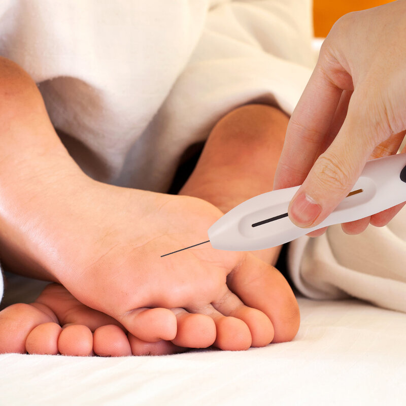10G ไนลอนทางการแพทย์โรคเบาหวาน Monofilament Sensory Tester เท้า Nerve เข็มปากกา Endocrinological Diagnostic เครื่องมือทดสอบ