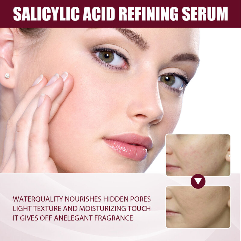 Soro facial ácido salicílico pele hidratante anti-envelhecimento essência óleo de fruto para acne poros finos cuidados beleza cuidados com a pele produtos