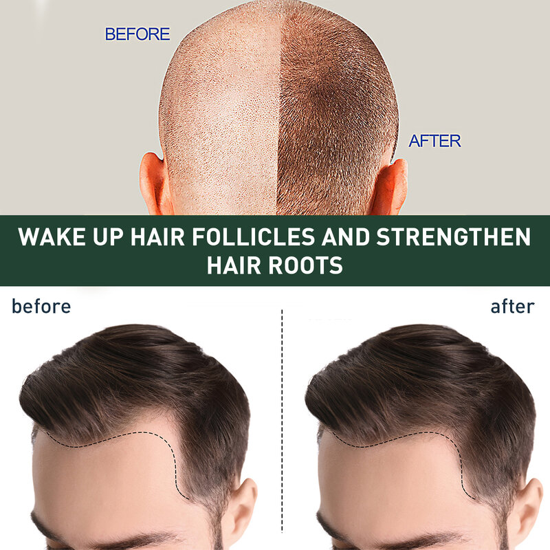 7 أيام الزنجبيل نمو الشعر المصل إصلاح فعال أصلع فقدان الشعر الجيني بعد الولادة فقدان الشعر الثعلبة الدهني النمو السريع