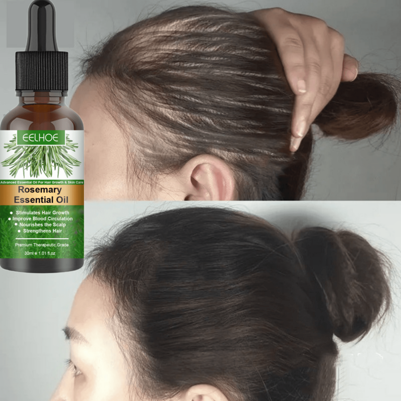 Rosemary crescimento do cabelo óleo essencial anti perda de cabelo rápido crescimento soro germinal reparação danos óleo calvície couro cabeludo tratamento produto