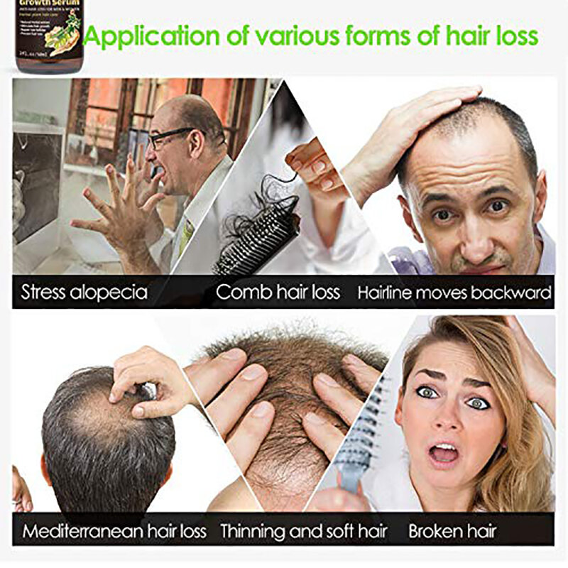 Soro de crescimento rápido eficaz anti-dano secura reparação cuidado do couro cabeludo produtos anti-perda de cabelo do pulverizador do soro do crescimento do cabelo do gengibre