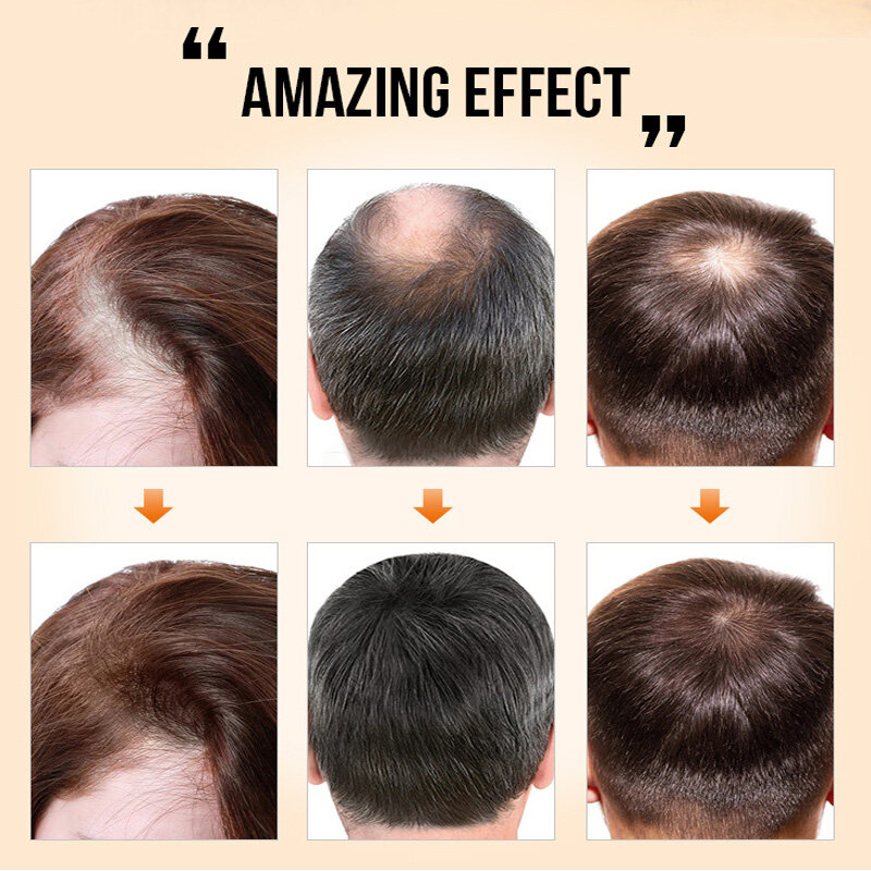 Après-shampoing unisexe, traitement Anti-perte de cheveux, sérum à croissance rapide, plus épais, doux, 20ml