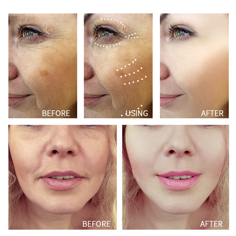 Fast onset Anti Wrinkle Face Cream Moisturizing Firming Skin Care Removing Fine Lines Moisturizing Whitening Cream
