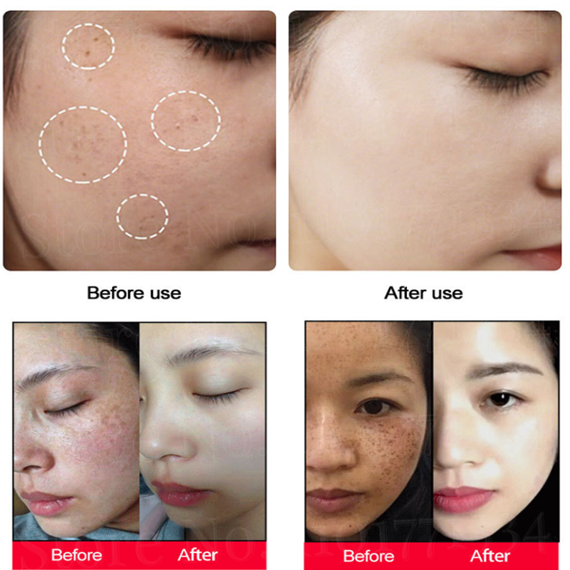 Facial Anti-Aging Anti-Wrinkle Firming Serum 10Ml เซรั่ม Essence 3 /5 /10ขวด face Serum Vitamin C Serum