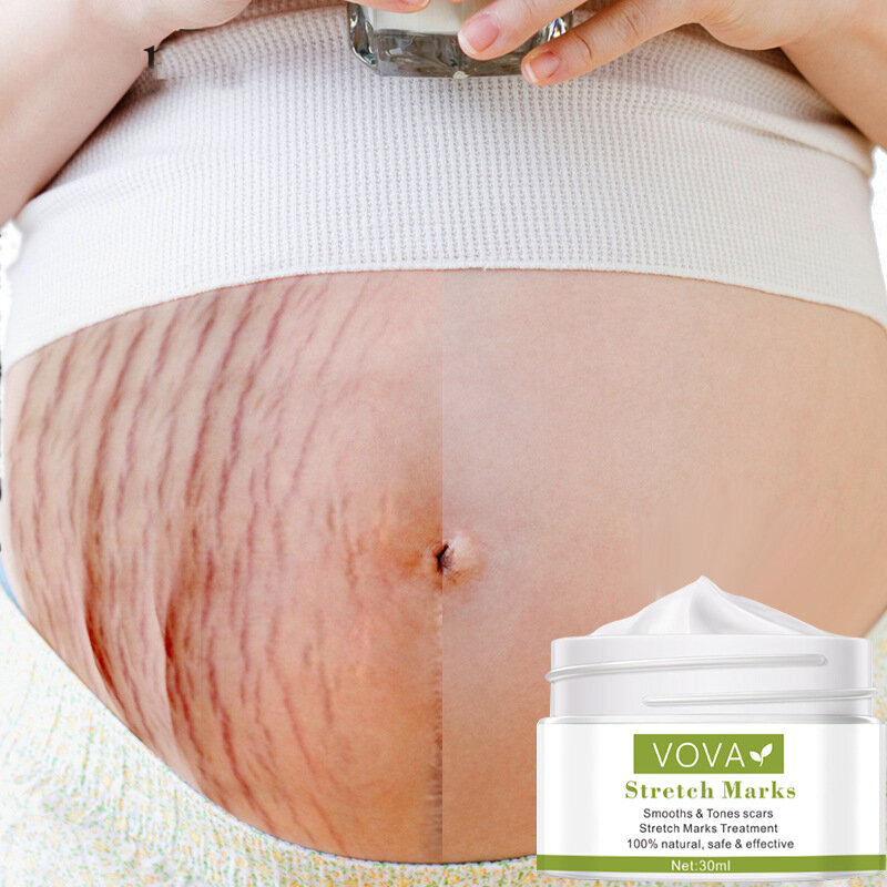 Crème anti-vergetures et cicatrices pour femmes enceintes, soins efficaces pour la peau, pour éliminer les vergetures, les fesses et les lignes de poitrine