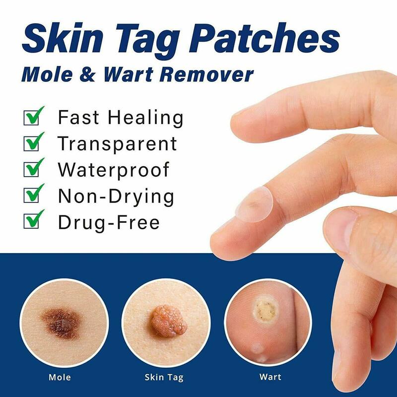 Parche impermeable para eliminar verrugas y lunares, calcomanías invisibles de curación rápida, tratamiento para el cuidado de la piel, 144 unidades