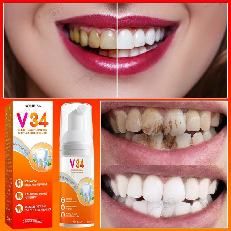 V34 منتجات تبييض الأسنان ، البقع النظيفة العميقة ، نظافة الفم ، إزالة البقع ، نزيف اللثة ، اللوحة