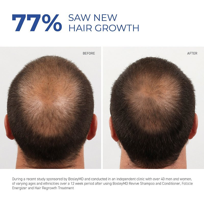 Fast Hair Growth Essence Natural Herbal Health Treatment Hair Loss Makes Hair Growth Longer and Thicker Hair Care Products