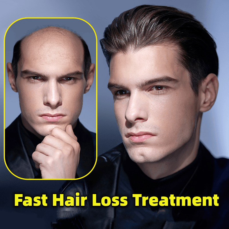 Serum penumbuh rambut cepat, perawatan folikel rambut, pertumbuhan rambut Seborrheic Alopecia, garis rambut setelah melahirkan, mencegah botak