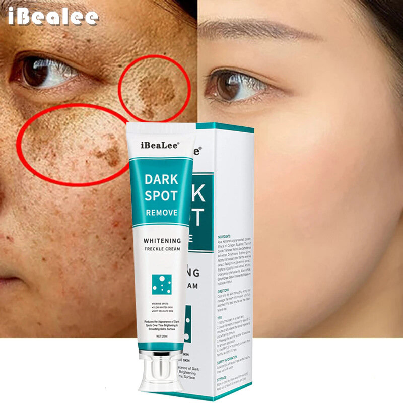 IBeaLee-crema blanqueadora para eliminar manchas oscuras de Melasma, eliminador de melaña, hidratante, ilumina la piel de la cara