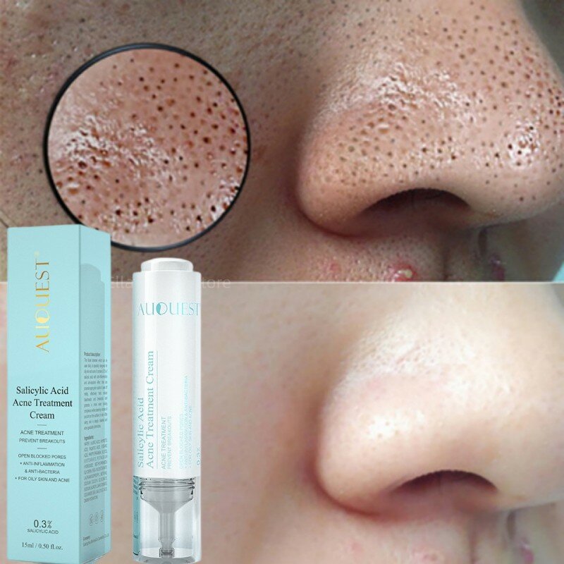 Acido salicilico Shrink Firm Pore Face Serum crema per l'acne controllo dell'olio punti neri rimuovi Anti brufolo macchie scure trattamento per la pelle sbiancante