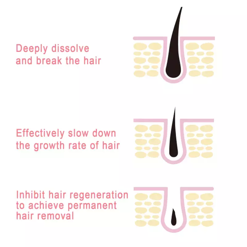 50/30/20/10ML potente Spray inibitore della crescita della depilazione per donne e uomini barba depilatoria indolore capelli Bikini gambe del braccio caldo
