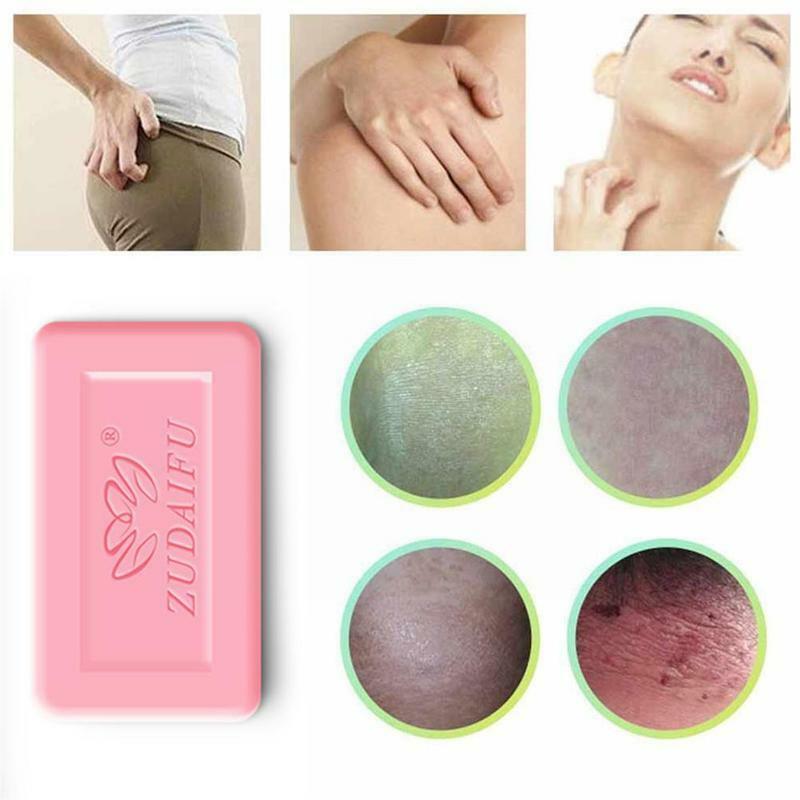 Mini 3pcs Sulfur Soap Skin Conditions Acne Psoriasis Seborrhea 7g/pc Fungus Shampoo Anti Whitening Soap Eczema Bath Soap I3p6