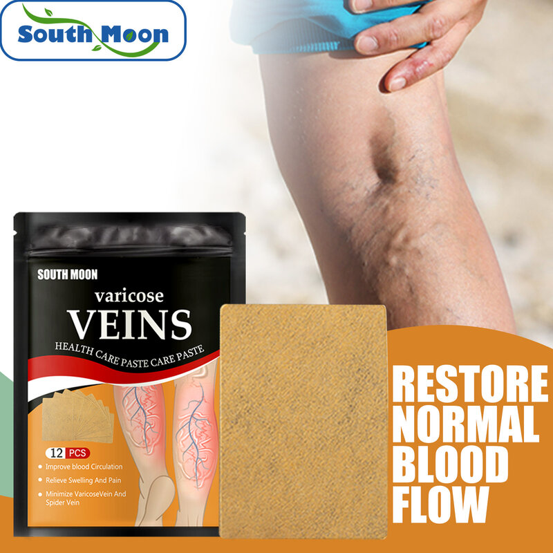 South Moon Varicose Veins Patch Phlebitis Spider Earthworm Leg Pain Relief Stickers Anti Swelling Vasculitis Treatment Plaster