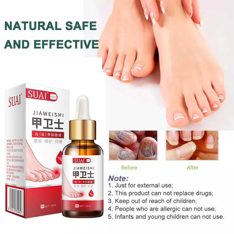SUAI Fungal Nail Treatment Oil Foot Repair Essence Toe Nail Fungus Removal Gel Anti Infection Cream Fungal Nail Removal 10ML