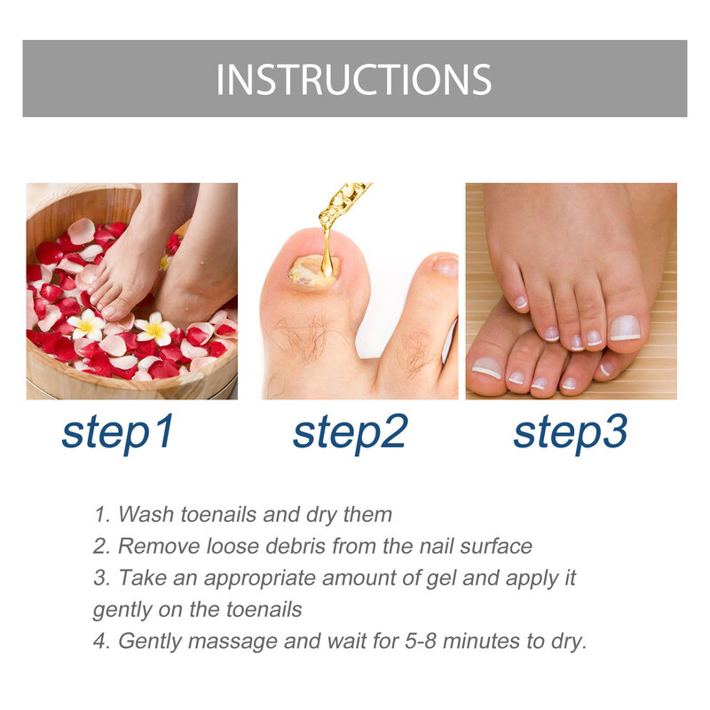 Eelhoe trattamento per unghie olio essenziale sbiancante per mani e piedi rimozione dei funghi delle unghie dei piedi infezione cura dei piedi smalto Gel per unghie