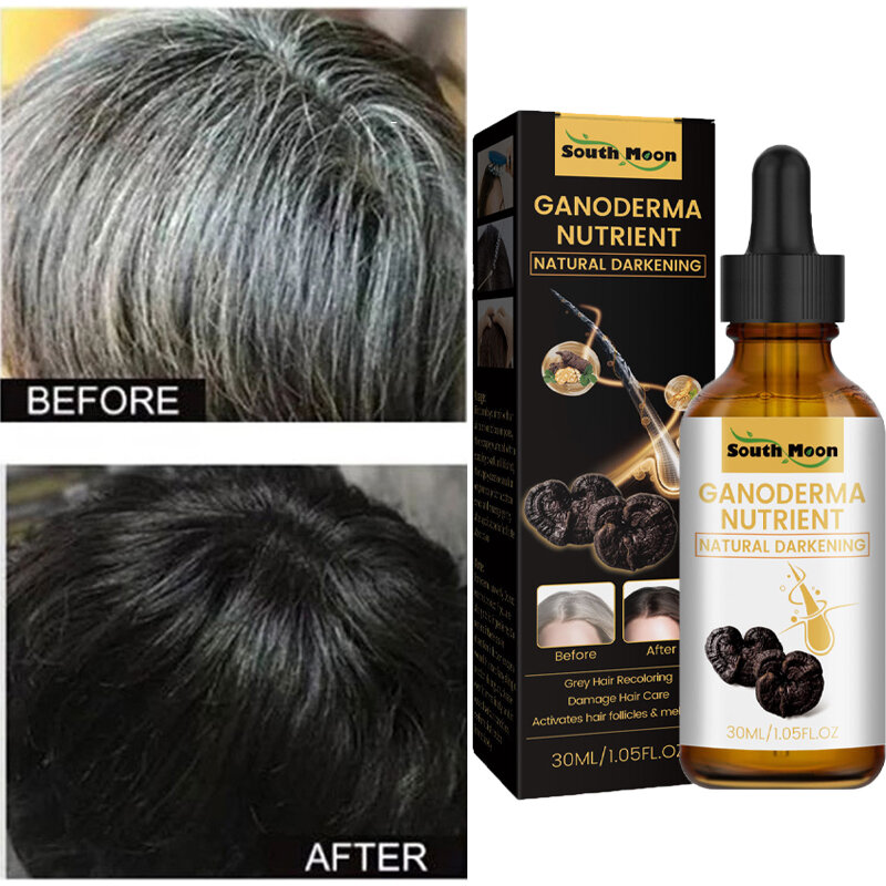 10PCS Gray White Hair Treatment Serum Liquid White To Black Natural Color Repair Nourish Product Anti Loss Hair Care Men Women