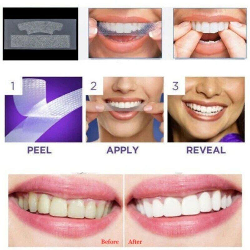 Flow Week Teeth whitening Strip White Teeth Strips Enamel Safe for Whiter Teeth Sensitivity Free Whitening Strips Oral Care Kit