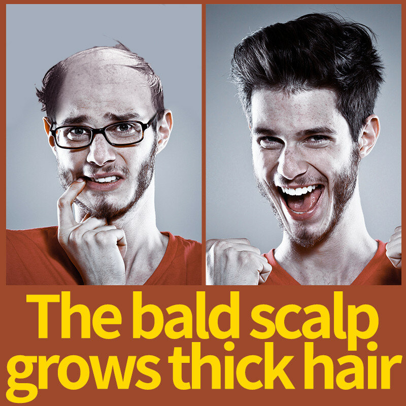 Produtos de crescimento rápido do cabelo Crescimento do cabelo Óleos Essenciais Anti Hair Loss Treatment Scalp Eficaz Baldness Repair Beleza Saúde