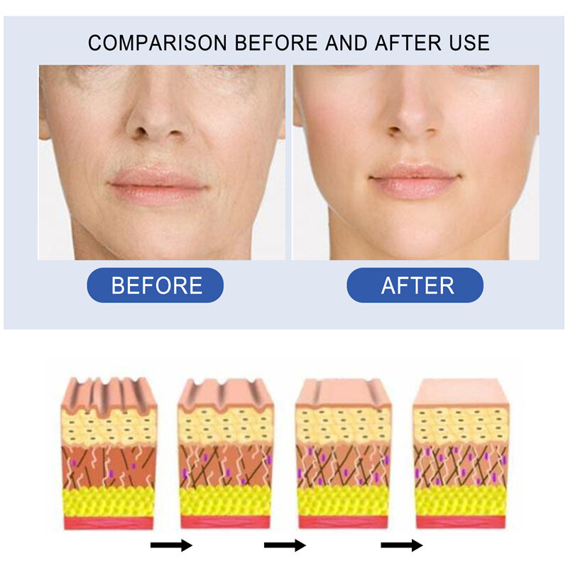 Peptídeo de cobre rosto e Remoção de Rugas e diminuir os poros soro soro soro do Cuidado Da Pele Tratamento Da Acne poros 30ML