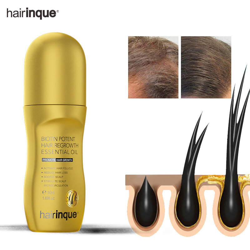 Hairinque – produit à croissance rapide des cheveux, vitamine B7, prévient la perte de cheveux, sérum de traitement du cuir chevelu, huile de soin pour hommes et femmes, 50ml