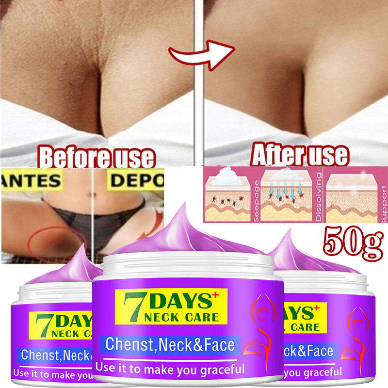7days Body Whitening Cream Underarm Armpit Knee Dark Spot Cream Skin Brighten Moisturizing Body Care Cosmetics for Women Men