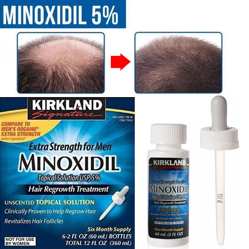 60Ml Kondisioner Serum Pertumbuhan Rambut Kirkland Dapat Memperbaiki Folikel Rambut dan Secara Efektif Meningkatkan Regenerasi Rambut dan Pertumbuhan Yang Cepat
