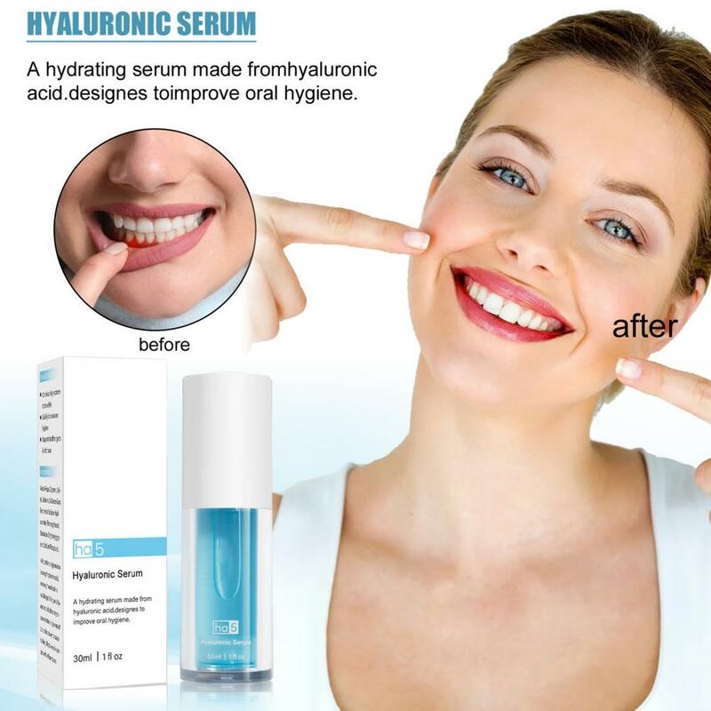 Removendo a placa segura nenhuma mousse dos dentes do ácido hialurônico dos dentes da sensibilidade para a beleza